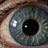 ¿Cómo afecta el láser al cuerpo humano?